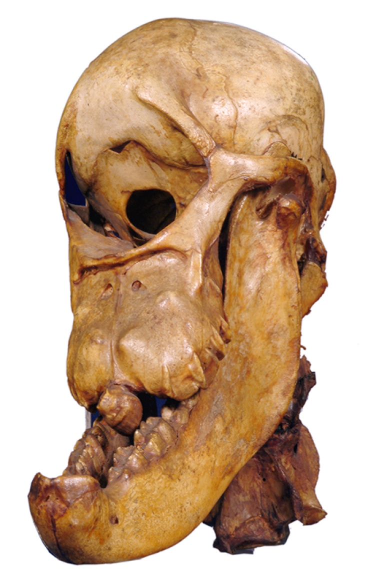 Photograph of the 'Bunyip skull', later identified by William Sharp Macleay (1792-1865) as a malformed horse foetus.